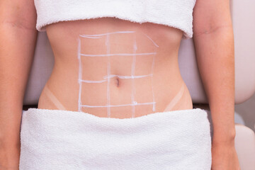 close-up photo of a woman's belly, photo of aesthetics, procedures on the abdomen. beauty clinic....