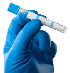 Researcher hold blood sample for New Variant of the Covid-19. Doctor in analysis lab