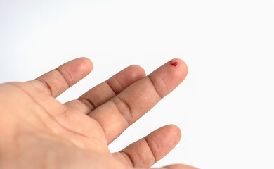 Finger, middle finger bleeding from a knife cut, accident