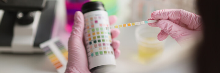 Test made with vial with a strip of reagent for urine analysis. Ketosis control and laboratory...