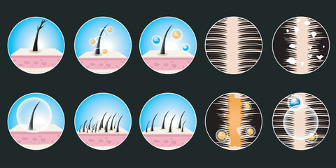 vector symbol collection of hair problems, dandruff, hair loss, and oily problems