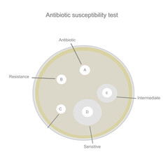 The result of Antibiotic susceptibility test: Resistance, Sensitive and Intermediate Bacteria or fungal that show inhibition zone around antimicrobial drugs pad (A, B, C, D, E).