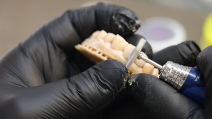 tooth making in the lab
