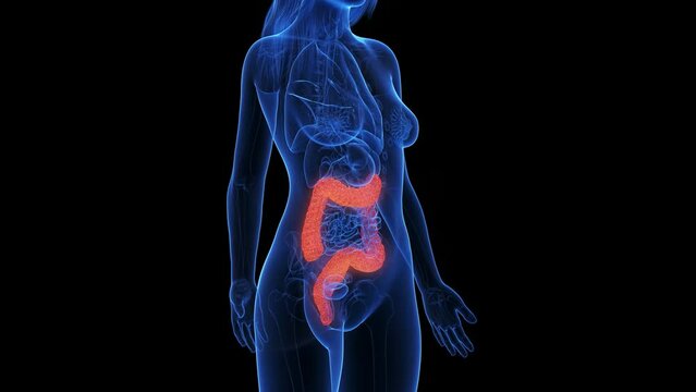 Animation of an inflamed colon