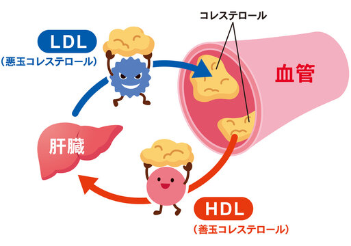 LDLとHDLの仕組み　脂質異常症　血管　コレステロール