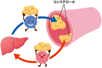 LDLとHDLの仕組み　脂質異常症　血管　コレステロール