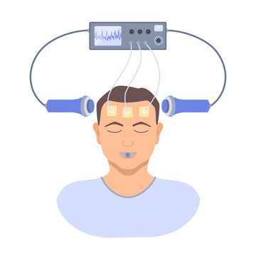 Electroconvulsive therapy for severe depression and schizophrenia treatment. ECT electrodes placement on a male patient. Brain stimulation equipment for major depressive disorders. Vector illustration