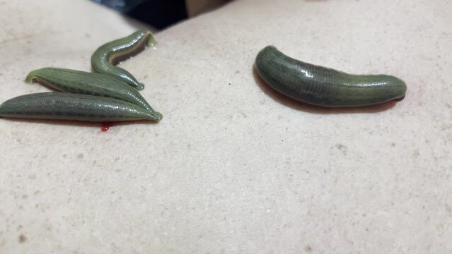 Revitalizing Blood Treatment: Harnessing the Power of Medicinal Leeches