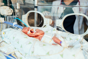 Unrecognizable nurse takes action and care for premature baby. Newborn is placed in the incubator....