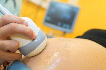 gynecologist checking female patients fetal life signs with ultrasound scanner
