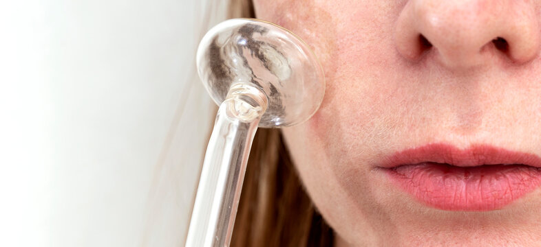 the girl does the darsonvalization procedure for the face