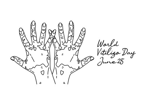 line art of world vitiligo day good for world vitiligo day celebrate. line art. illustration.