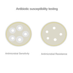The result of Antibiotic susceptibility testing : Antimicrobial Sensitivity and Resistance for determine the microbial (bacteria or fungus) growth with antibiotic drugs pad.