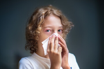Child with swollen pink eye. Eyes infection.