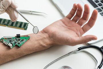 Hand with implantation of micro chip. X-Ray view close-up. Chipization of people, control population