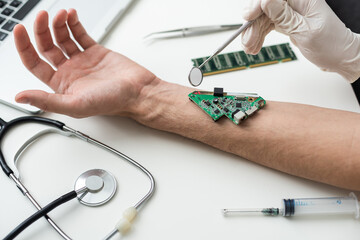 The cosmetic surgeon made a small incision to insert the chip into the patient's arm. Biotechnology, electronic documents and technological future concept. Bionic chip. Biohacking