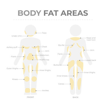 Body fat areas medical poster with fat storage problems.
Editable vector infographic of human body pictogram with text and fat deposit areas.
Location of adipose tissue in front and back body parts
