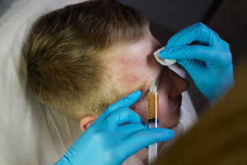 Injection at spa salon. Doctor hands in gloves. Closeup. Pretty male patient. Beauty treatment....