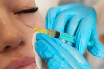 Syringe with a patient's blood plasma in a cosmetologist's hand for a plasmolifting of a woman's...