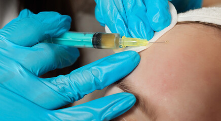 Syringe with a patient's blood plasma in a cosmetologist's hand for a plasmolifting of a woman's...