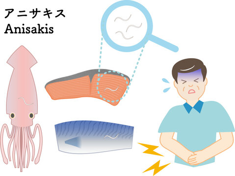 アニサキス（寄生虫）による食中毒のイラストセット