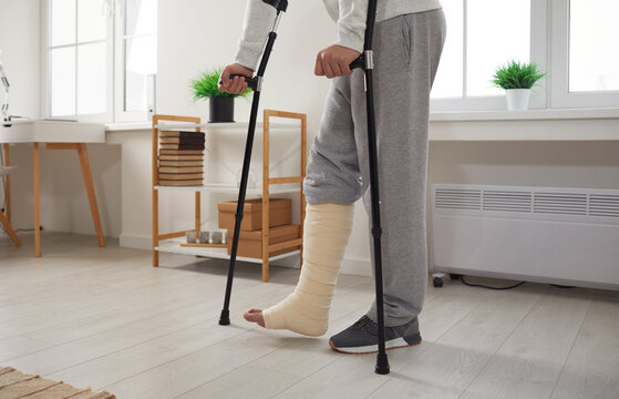 Cropped shot of a young unrecognizable man with a broken leg walking with orthopedic elbow crutches in the living room at home. Accident, injury and rehabilitation concept