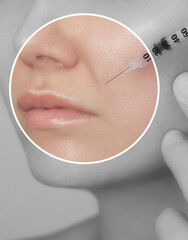 Cosmetologist does prp therapy anti wrinkle and aging skin on the chin and on the face of a...