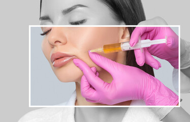 Cosmetologist does prp therapy anti wrinkle and aging skin on the face of a beautiful woman in a...