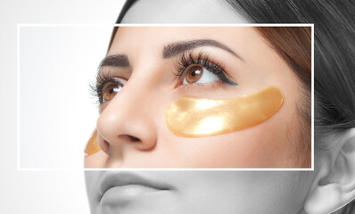Collagen gold patches on the skin of the eyelid of a beautiful woman.Caring for the skin around the...