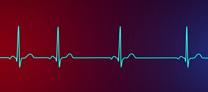 Electrocardiogram ECG displaying sinus arrhythmia, 3D illustration