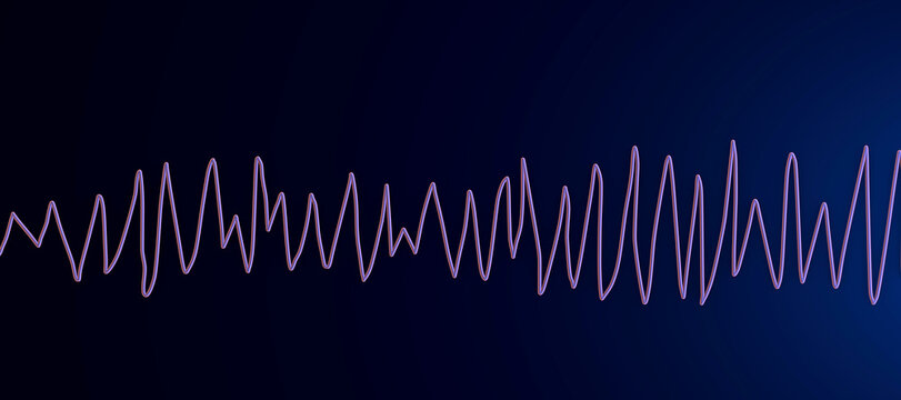 Electrocardiogram ECG displaying Torsades de pointes rhythm, 3D illustration