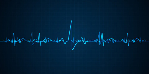 Emergency ekg monitoring. Blue glowing neon heart pulse. Heart beat. Electrocardiogram - 611737243