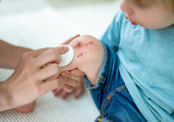 Toddler boy with scraped knees. Parent helping her child perform first aid knee injury after an...