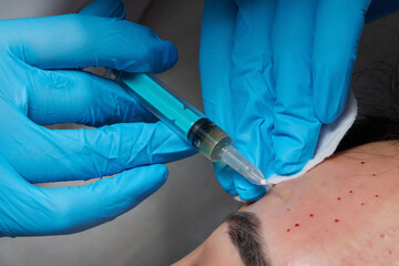 Injection at spa salon. Doctor hands in gloves. Closeup. Pretty male patient. Beauty treatment....