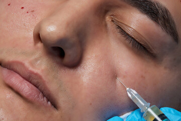 Injection at spa salon. Doctor hands in gloves. Closeup. Pretty male patient. Beauty treatment....