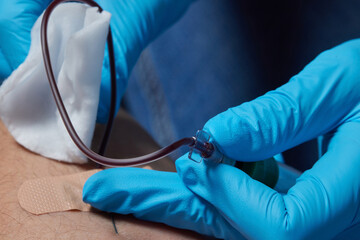 the doctor collects blood in a syringe, Nurse takes blood from the veins on the arm.