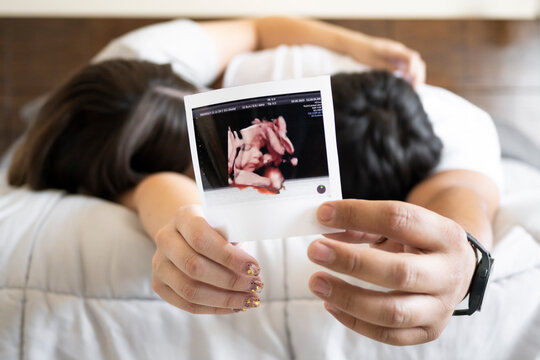 couple showing an ultrasound image of their baby in their hands selective focus.