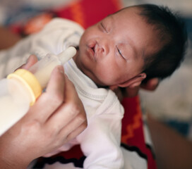 Baby with cleft lip, milk and mother feeding from bottle for nutrition, health and wellness....