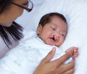 Newborn, cleft palate and parent care for a baby happy in a home bed with a smile in a bedroom or medical centre. Health, healthcare and young child or kid bonding with mother with love and comfort - obrazy, fototapety, plakaty
