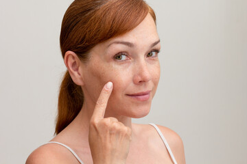 Portrait of cropped caucasian middle aged woman face with freckles showing on skin by index finger...