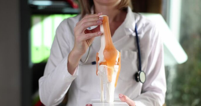 Traumatologist shows anatomy of ligament and muscle on artificial model of knee joint. Traumatic joint injury
