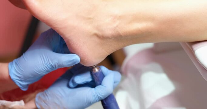 Manicurist using special grinding equipment to polish legs. Podiatry specialist in gloves cleans client skin from corns and calluses with a professional tool