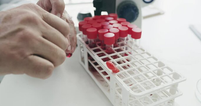 Blood sample, lab test and scientist hands with medical, health and wellness sample for research. Laboratory, science investigation and pathology testing for healthcare and hospital dna in a clinic