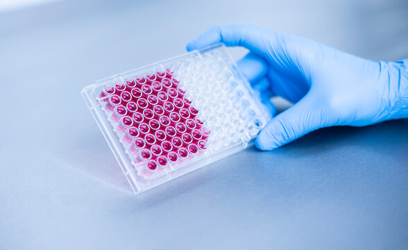 Cell culture at the cell culture genetic bioprocess medicine and medical labrotory