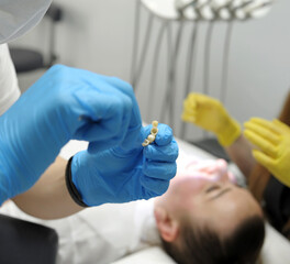 close-up of nurse's hands smearing glue special fastening material on patient's temporary teeth prosthetics dental treatment in background yellow gloves 