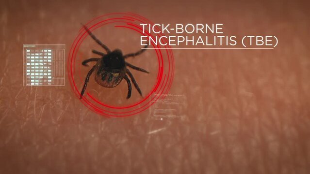 Tick on human skin is scanned for Tick-borne encephalitis disease infection. Digital HUD overlay
