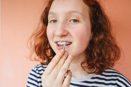 Girl cleaning dental braces with interdental brush