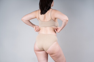 Overweight woman with fat back, hips and buttocks, obesity female body on gray background