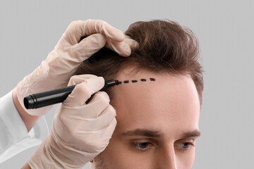 Doctor marking young man's forehead with hair loss problem on grey background, closeup