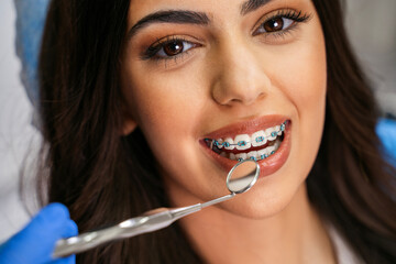 Closeup shot of charming young woman with dental braces having checkup , looking at camera, beautiful eye glow 